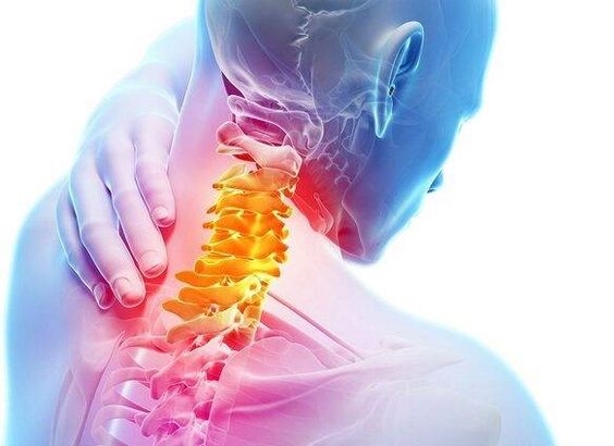 Osteochondrozė
