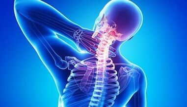 Gimdos kaklelio osteochondrozės simptomai ir gydymas