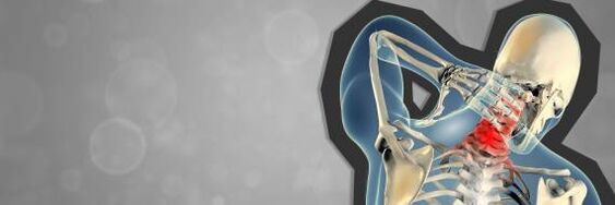 Gimdos kaklelio stuburo osteochondrozė